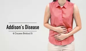 Addison’s disease