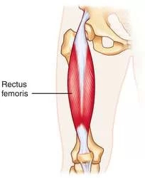 Rectus Femoris Muscle